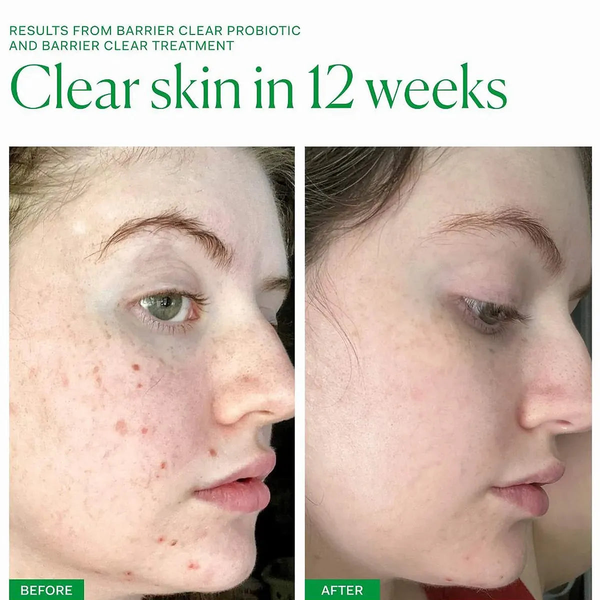 Axis-Y Dark Spot Correcting Glow Serum 50ml