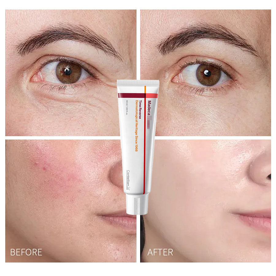 Centellian24 Madeca Cream Time Reverse 50mL