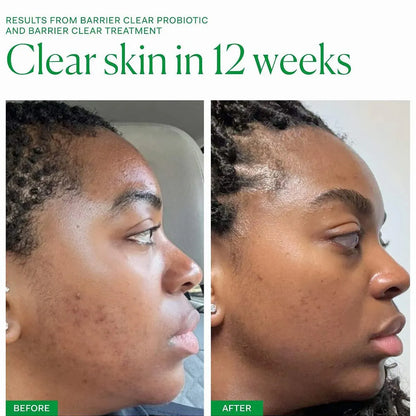 Axis-Y Dark Spot Correcting Glow Serum 50ml